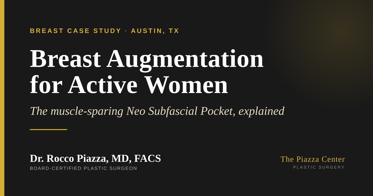 Breast Augmentation for Active Women: How the Neo Subfascial Pocket Keeps Results Natural