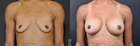 Patient 132790659