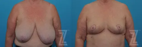 Patient 132886611
