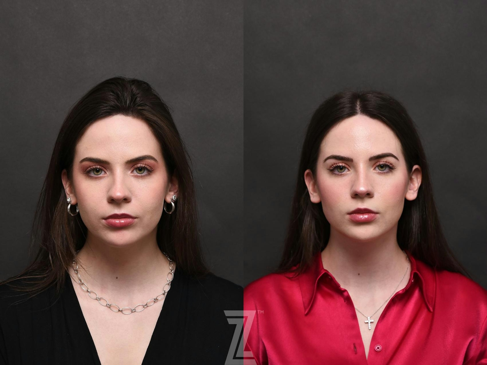 Austin Injectable Fillers Before & After Gallery - Patient 132963119 - Image 1 - The Piazza Center