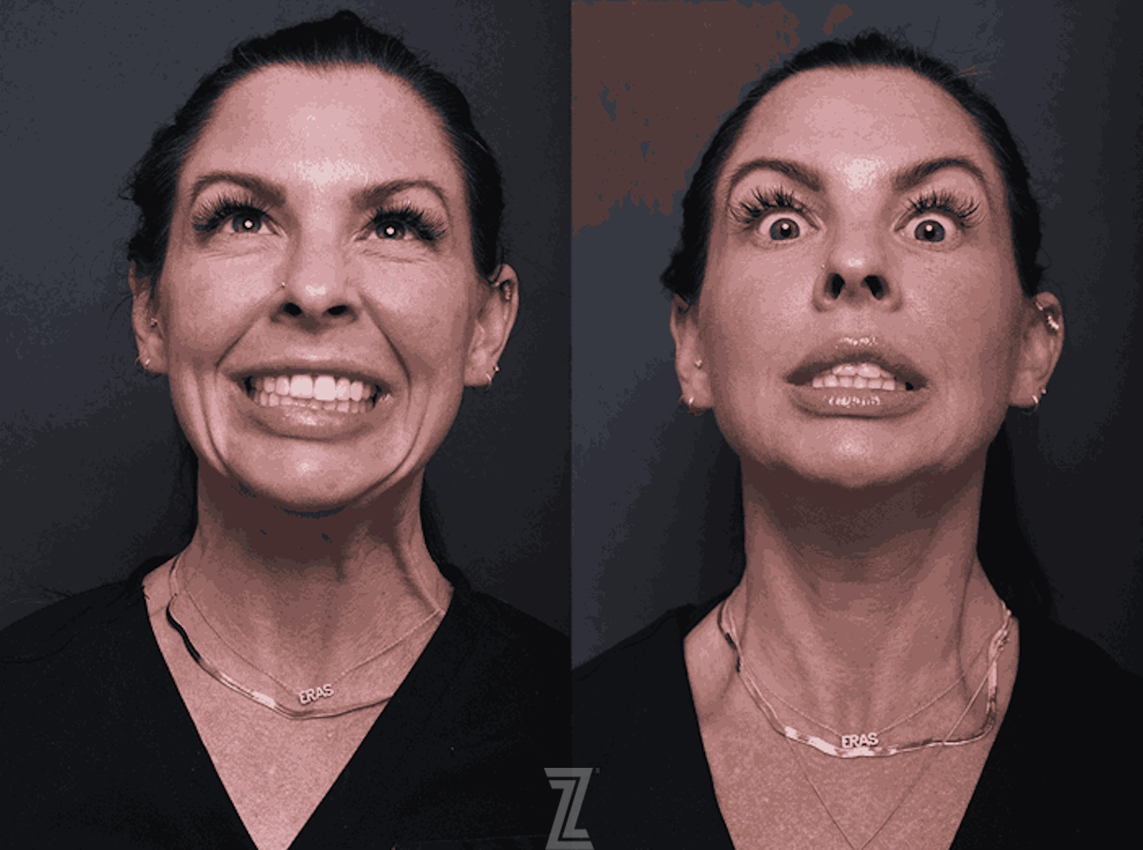 Austin Wrinkle Relaxers - The Piazza Center